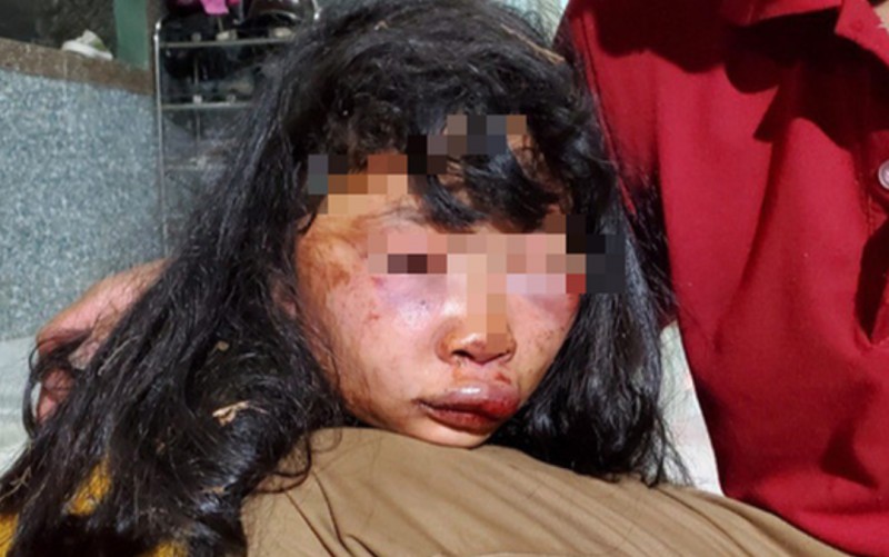 Truy bắt kẻ tấn công nữ sinh lớp 6 "dập mặt" bất tỉnh trong lô cao su - Ảnh 1.